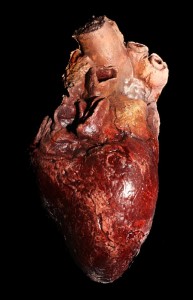 What happened to the U.S. soldiers heart remains a mystery. 