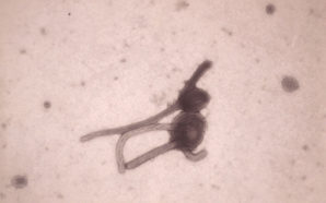 The deadly Ebola virus viewed through an electron microscope . 